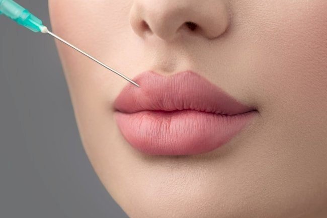 How the Best Aesthetic Clinic in Dubai Creates Perfect Lip Contours with Russian Lip Fillers