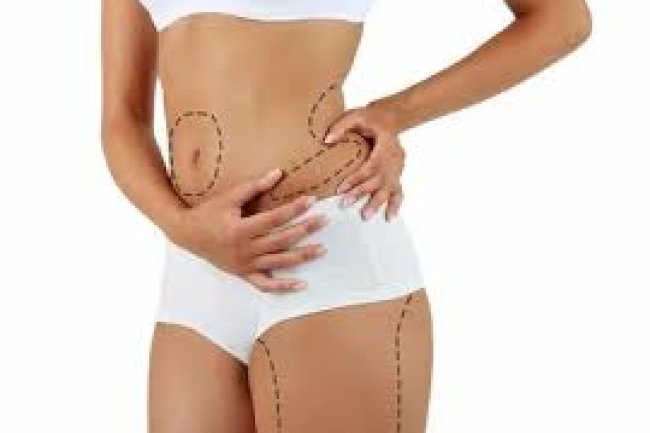 Liposuction in Delhi: What It Can Actually Do for Your Body