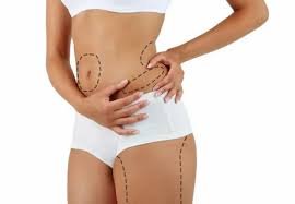 Liposuction in Delhi: What It Can Actually Do for Your Body