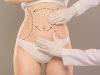 How to Combine Tummy Tuck with Weight Management in Islamabad