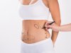 Sculpted Secrets: The Liposuction Obsession Behind the Glamour