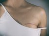 The Importance of Choosing the Right Breast Cancer Reconstruction Specialist