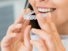How Invisalign Works: The Step-by-Step Process Explained