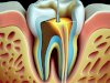 Best Root Canal Specialists in Islamabad: 2025 Guide