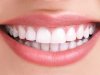 Teeth Whitening Cost: Is It Cheaper With Insurance?