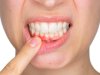 What Your Gums Say About Your Health - Dental Pros Explain