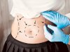 Bariatric Surgery Safety: What Patients Must Know Today