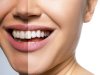 Complete Family Dental Care in Toronto: Your Smile Deserves the Best