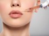 Can Lip Fillers Help With Aging Lips?