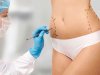 Why Choosing the Best Fat Transfer Surgeons in Dubai Matters for Results