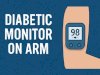 Diabetic Monitor on Arm: A Revolutionary Approach to Blood Glucose Management with Linx CGM