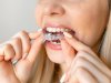Invisalign Braces Treatment: Tracking Progress Effectively