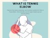Tennis Elbow: Causes, Symptoms, Diagnosis & Effective Treatments