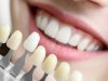 Top 10 Teeth Whitening Ingredients Ranked by Safety & Effectiveness