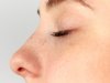 What is Rhinoplasty in Islamabad? A Complete Beginner’s Guide