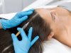 Hair Loss Treatment: What’s the Science Behind Regrowth Claims?