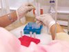 How a Gardnerella Vaginalis Test Helps Rule Out Other Infections