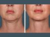 Best Doctors in Dubai Leading PRP Treatment Excellence