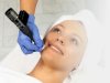 Microchanneling Treatment Benefits for Healthier Skin