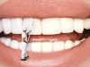 How Can a Dentist in Scarborough Help Protect Your Smile?
