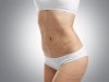 Are You an Ideal Candidate for Transformative Liposuction Results?