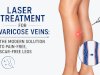 Laser Treatment for Varicose Veins: The Modern Solution to Pain-Free, Scar-Free Legs