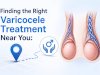 Finding the Right Varicocele Treatment Near You: What Every Man Should Know Before Choosing Care