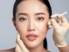 The Role of Precision Techniques in Achieving Balanced Botox Results