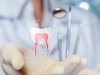 Dental Implants in Chilliwack: A Long-Term Solution for Missing Teeth