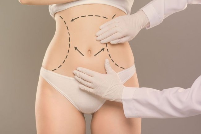 How to Combine Tummy Tuck with Weight Management in Islamabad