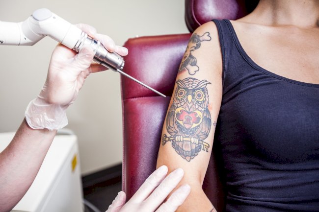 How PicoSure Laser Works: The Science Behind Tattoo Removal