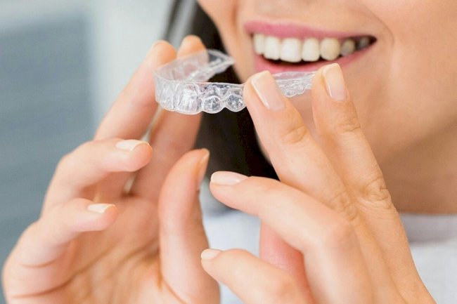 How Invisalign Works: The Step-by-Step Process Explained