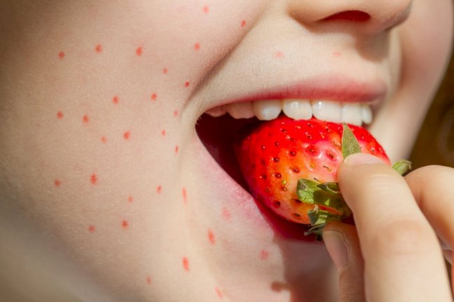 How Accurate are Food Allergy Tests in Dubai?