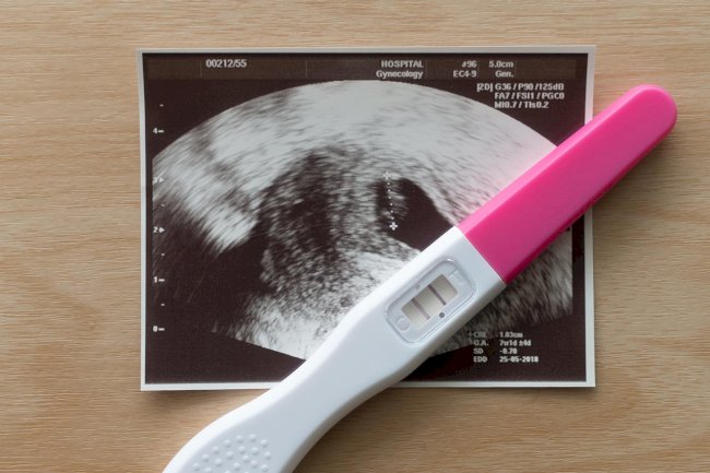 Early Pregnancy Scan: An Ultimate Guide