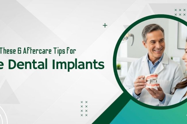 Know These 6 Aftercare Tips for the Dental Implants