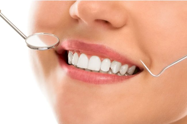 Teeth Whitening Treatments That Work in Dubai