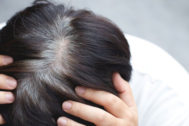 Can White Hair Be Removed on Dark Skin?