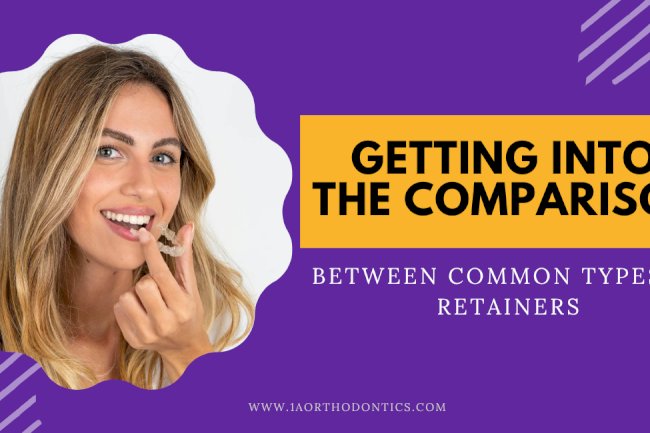 Getting into the Comparison Between Common Types of Retainers