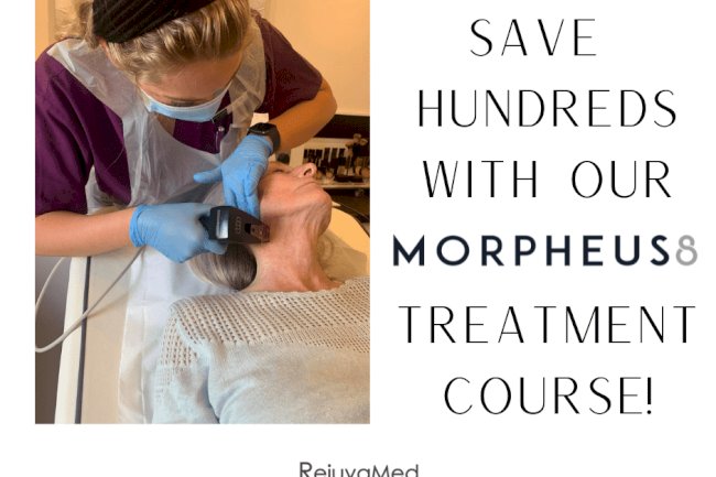 What Happens During a Morpheus8 Session? A Step-by-Step Treatment Overview