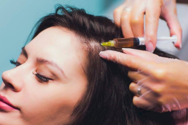 Tackle Hair Thinning with the Cheapest PRP Treatment in Dubai