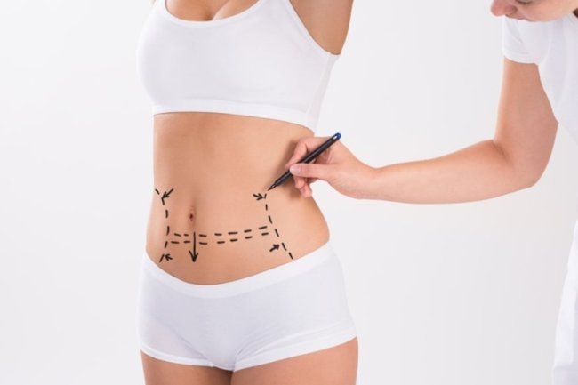 Skin Tightening and Tummy Tuck in Islamabad