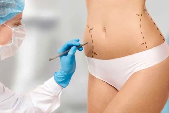Why Choosing the Best Fat Transfer Surgeons in Dubai Matters for Results
