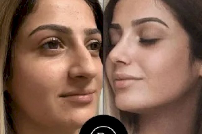 What Happened When I Visited the Best Aesthetic Clinic in Dubai