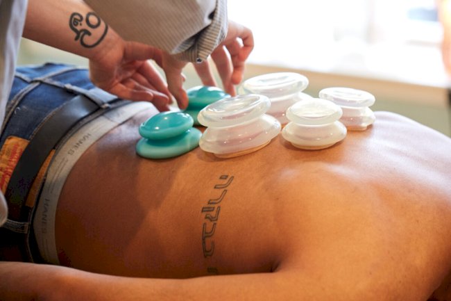 Cupping Therapy in Philadelphia: Ancient Healing Reimagined