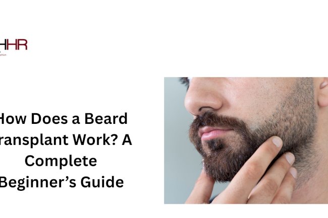 How Does a Beard Transplant Work? A Complete Beginner’s Guide