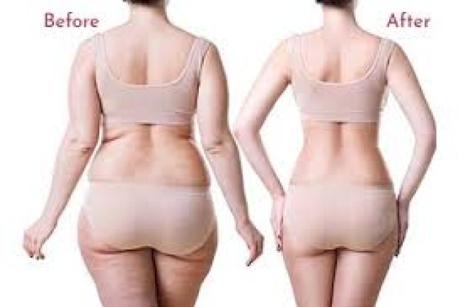 Sculpt Your Best You: Expert Body Contouring, Liposuction & 6-Pack Abs Surgery in Gurgaon