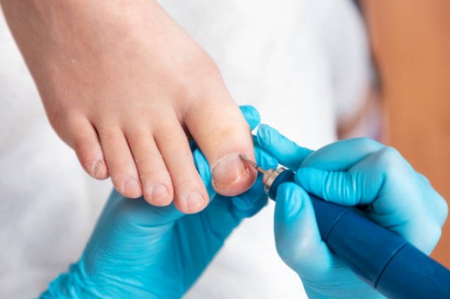 Difference Between Cosmetic Foot Care and Podiatry in Edinburgh