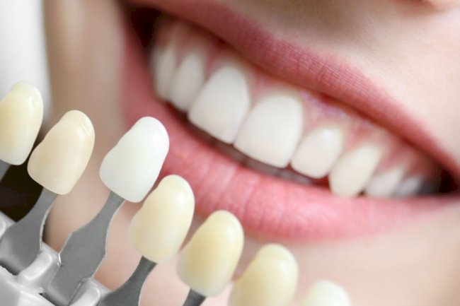 Top 10 Teeth Whitening Ingredients Ranked by Safety & Effectiveness