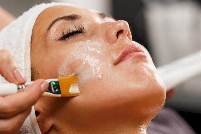 What Are the Benefits of Getting a Chemical Peel?