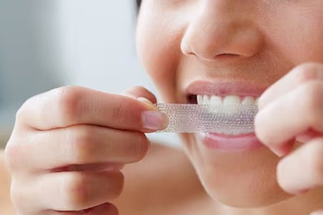 Smile Brighter Every Day: The Power of Crest 3D Whitestrips